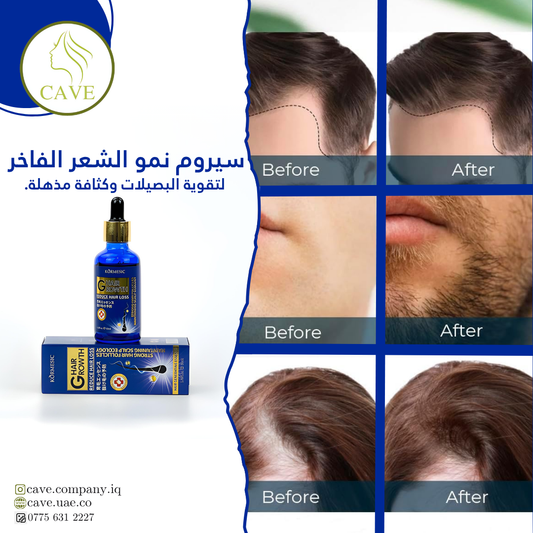سيروم نمو الشعر  – لقوة وكثافة مذهلة